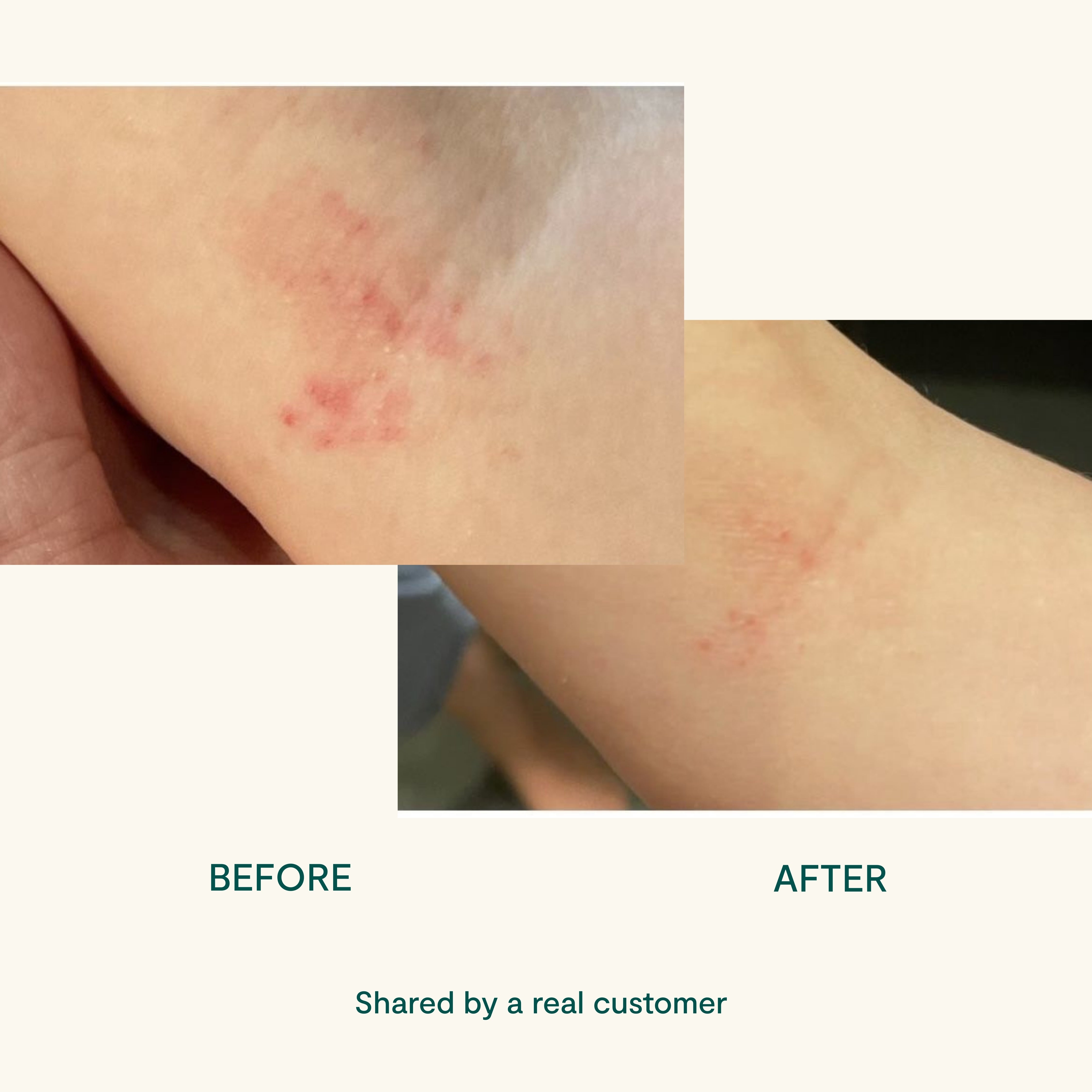 BEETL Baby Balm texture – thick natural barrier balm