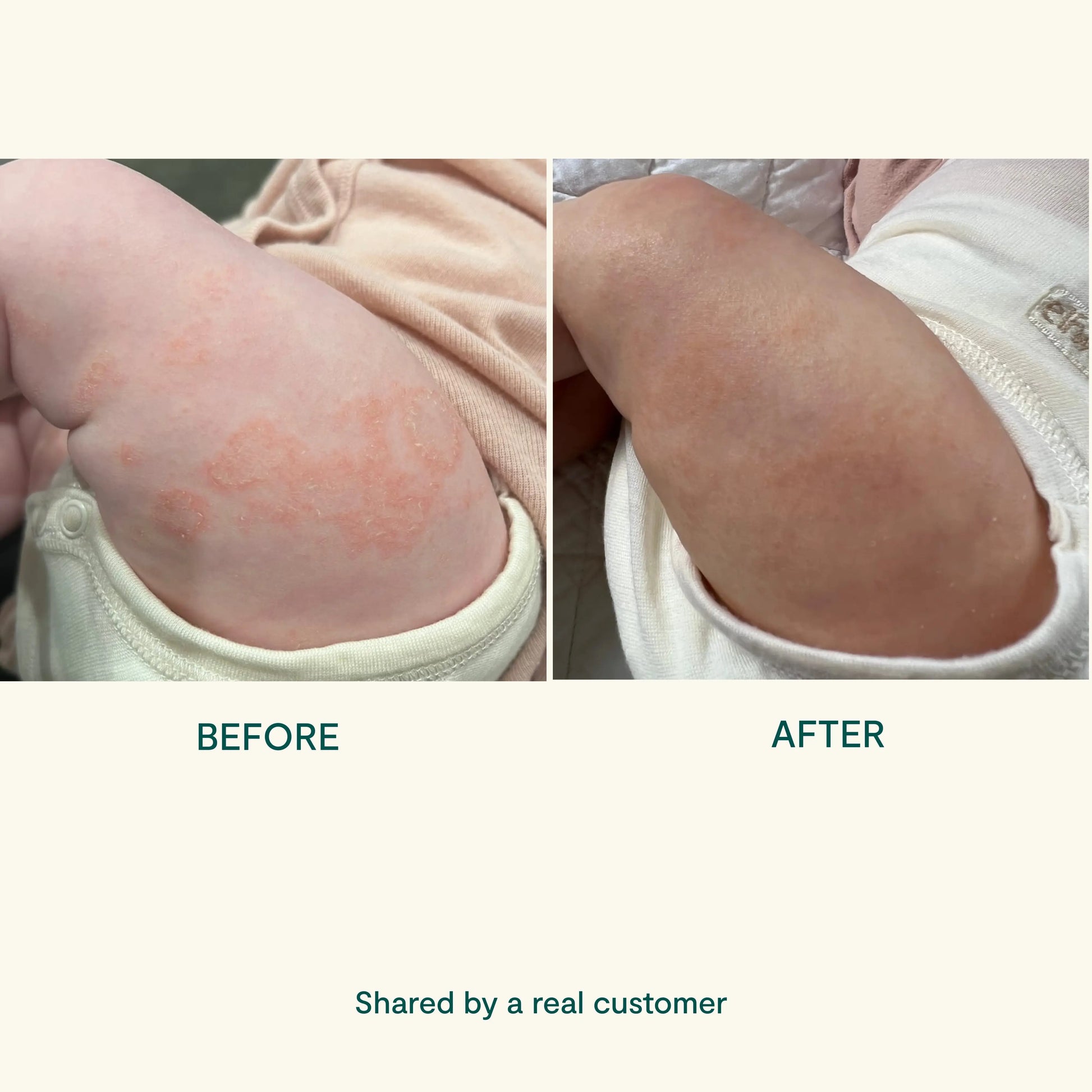 BEETL Baby Cream 250ml – natural baby skincare Australia