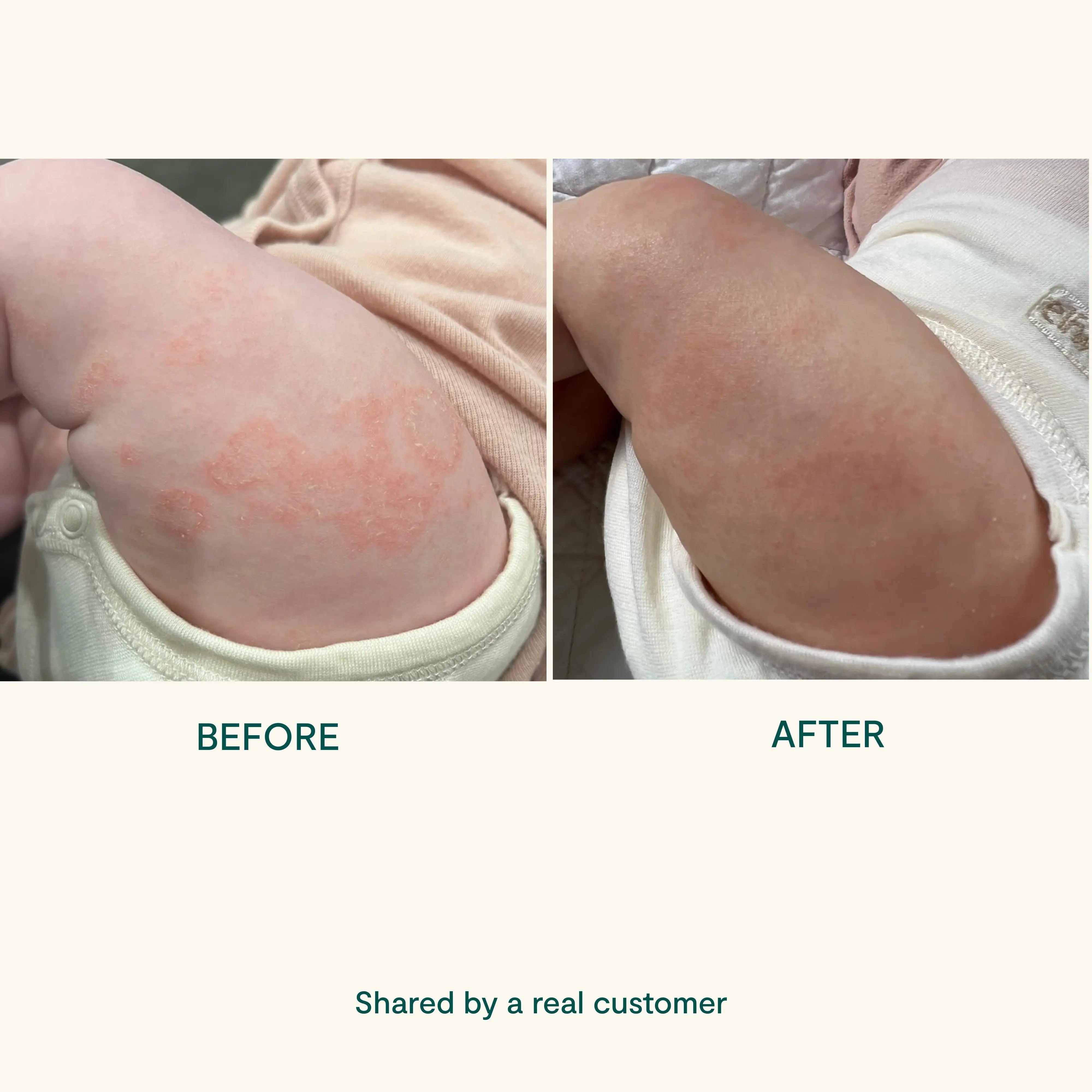 BEETL Baby Cream 250ml – natural baby skincare Australia
